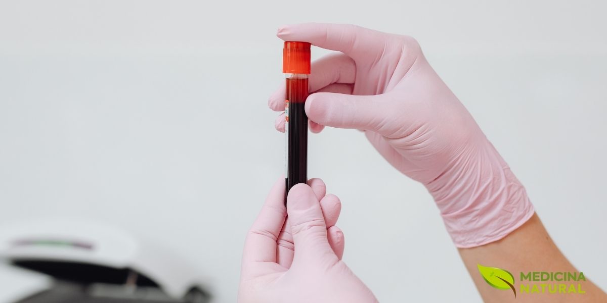 Palidez, falta de ar ao esforço, queda de cabelo e unhas fracas podem aparecer na anemia ferropriva. Além do ferro da dieta, inflamação e estresse oxidativo podem piorar o cansaço. Crajiru concentra pigmentos e flavonoides com ação antioxidante e anti-inflamatória descrita em estudos experimentais. Isso pode ajudar a compor uma rotina de bem-estar enquanto o ferro é corrigido.