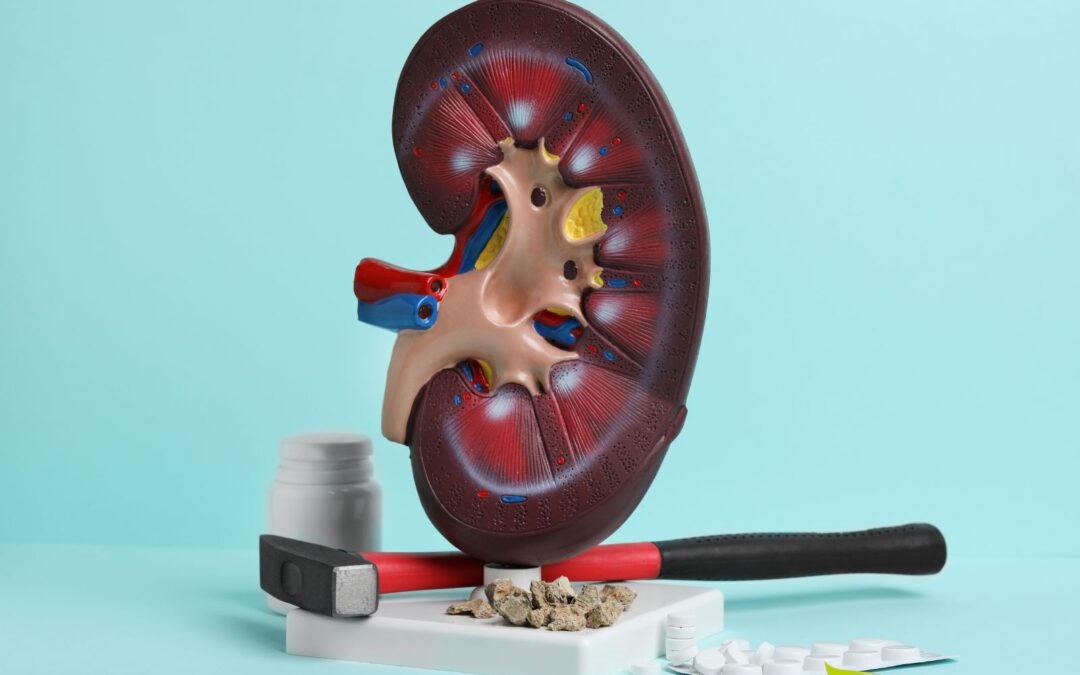 Os 10 Melhores Chás Para Dissolver Pedras nos Rins