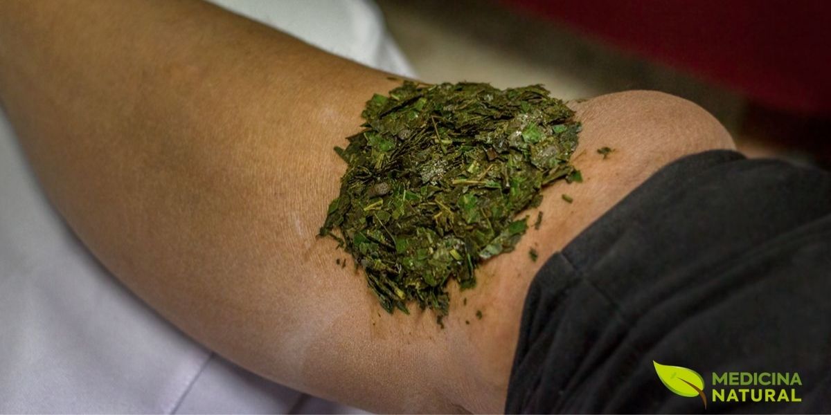 O cataplasma é uma preparação tópica milenar que consiste na aplicação direta de ervas frescas ou secas trituradas sobre a pele. Este método terapêutico permite que os princípios ativos das plantas sejam absorvidos através da pele, proporcionando alívio localizado para inflamações, dores musculares, contusões e problemas dermatológicos. A preparação envolve macerar as ervas até formar uma pasta úmida, que é então aplicada sobre a área afetada e coberta com um tecido limpo para manter o calor e a umidade.