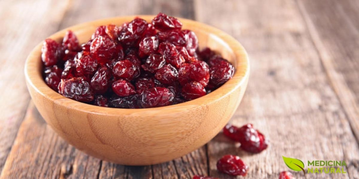 Cranberries secas (Vaccinium macrocarpon). A desidratação dos frutos concentra os nutrientes e compostos bioativos, tornando as cranberries secas uma opção prática e portátil para consumo diário. Durante o processo de secagem, os frutos retêm grande parte das proantocianidinas, antocianinas e outros polifenóis, embora em concentração ligeiramente reduzida em comparação aos frutos frescos. As cranberries secas são frequentemente adoçadas durante o processamento devido ao sabor extremamente ácido dos frutos naturais. Para fins medicinais, prefira versões com menor adição de açúcar. Uma porção de 40g de cranberries secas fornece aproximadamente 30-40 mg de PACs. Podem ser consumidas puras como lanche, adicionadas a cereais, saladas, iogurtes ou utilizadas em preparações culinárias.