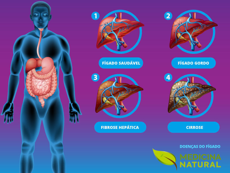 Doenças do fígado