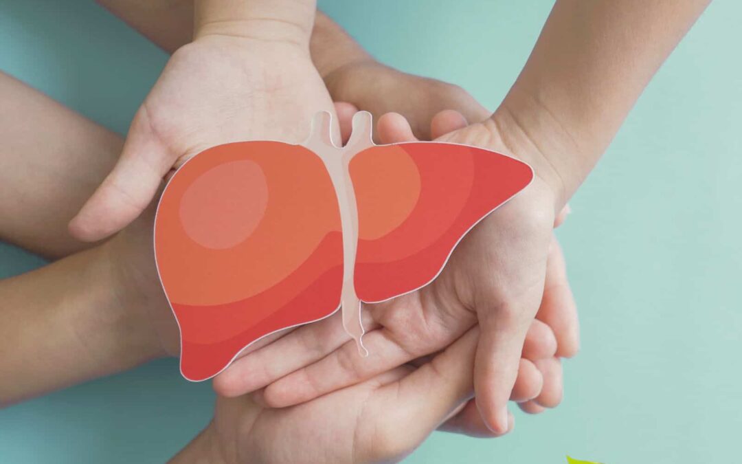 Gordura no fígado: Causas, sintomas, como tratar e eliminar