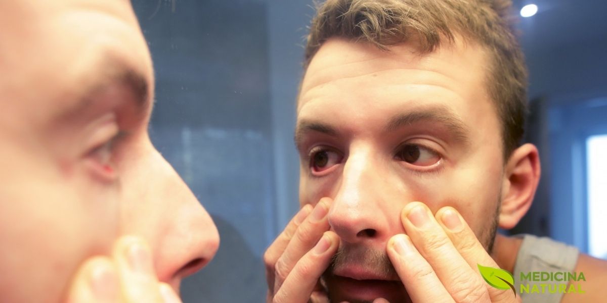 A palidez da pele e das mucosas pode ser um sinal de alerta para a anemia. A falta de vitamina B12 afeta a produção de glóbulos vermelhos, o que pode levar a uma aparência mais pálida e a uma sensação de fraqueza.