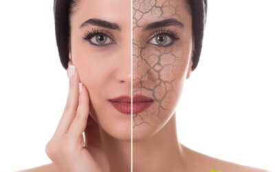 Pele seca ou ressecada: causas e tratamento natural